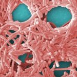 Legionella